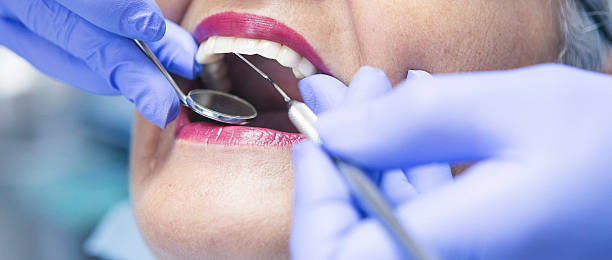 Best Emergency Root Canal Treatment in Big Rock, IL